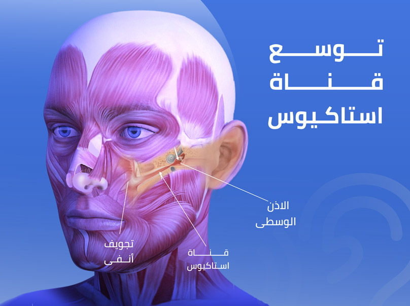 توسع قناة استاكيوس