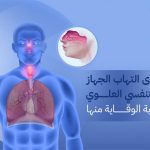 التهاب الجهاز التنفسي العلوي