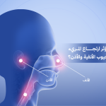 ارتجاع المريء