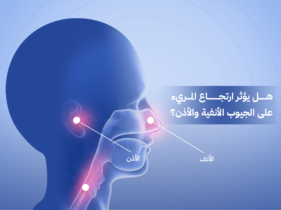 ارتجاع المريء