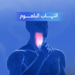 التهاب البلعوم
