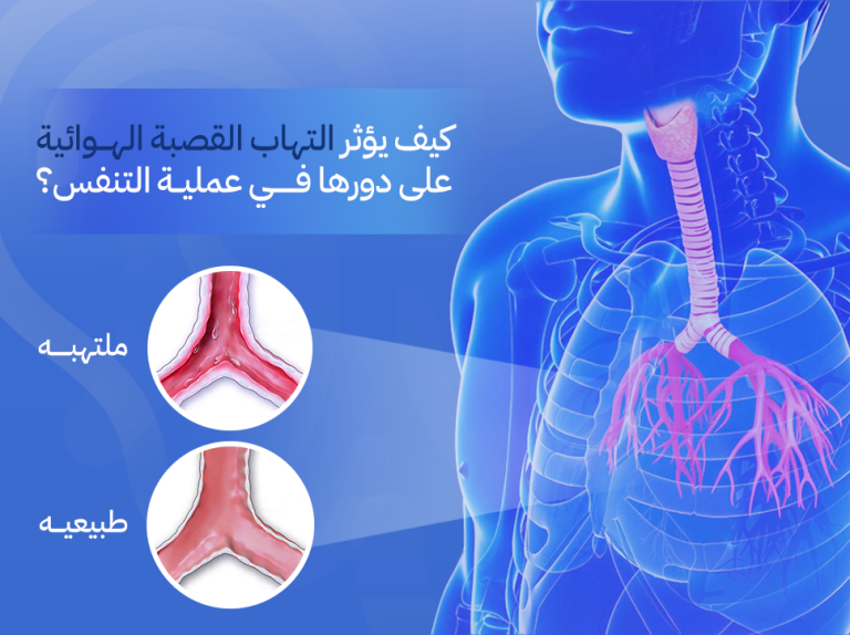  كيف يؤثر التهاب القصبة الهوائية على دورها في عملية التنفس