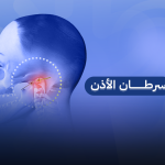 سرطان الاذن