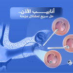 أنابيب الأذن