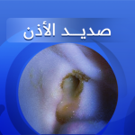 صديد الأذن