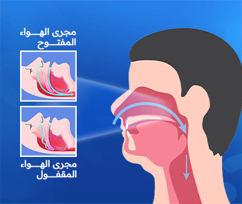 انقطاع النفس أثناء النوم