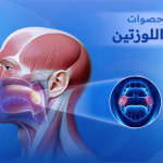 حصوات اللوزتين