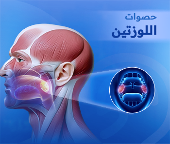 حصوات اللوزتين.. مشكلة صحية صغيرة بأعراض مزعجة