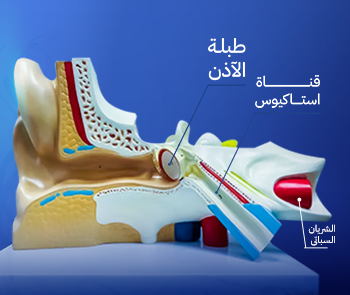 قناة استاكيوس