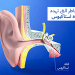 قناة استاكيوس