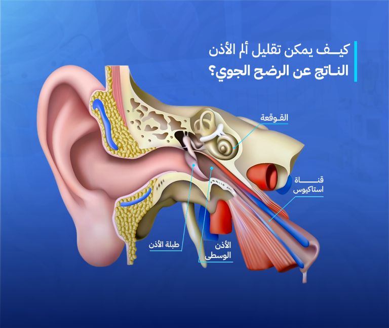 الرضح الجوي