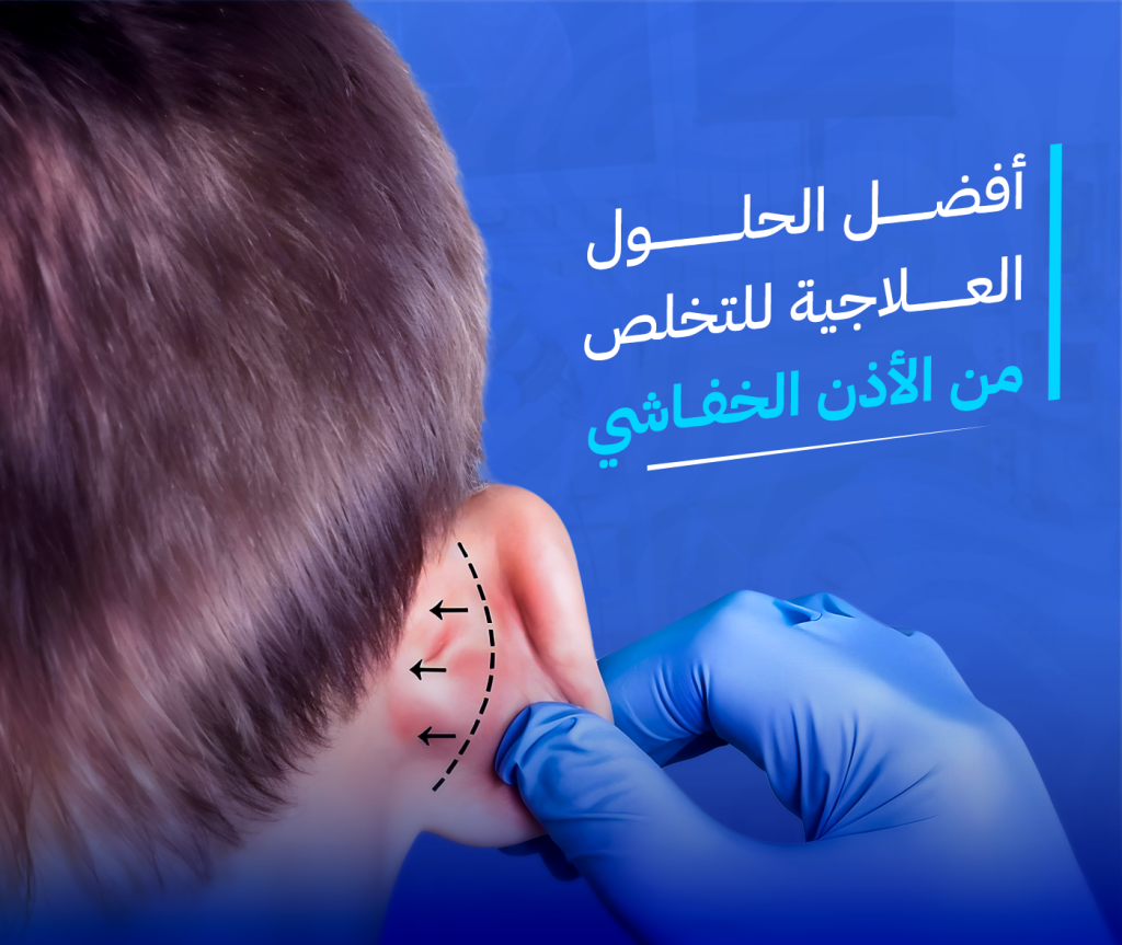 الاذن الخفاشية