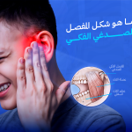 المفصل الصدغي الفكي