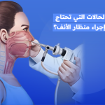 منظار الأنف