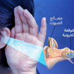 زراعة الحلزون