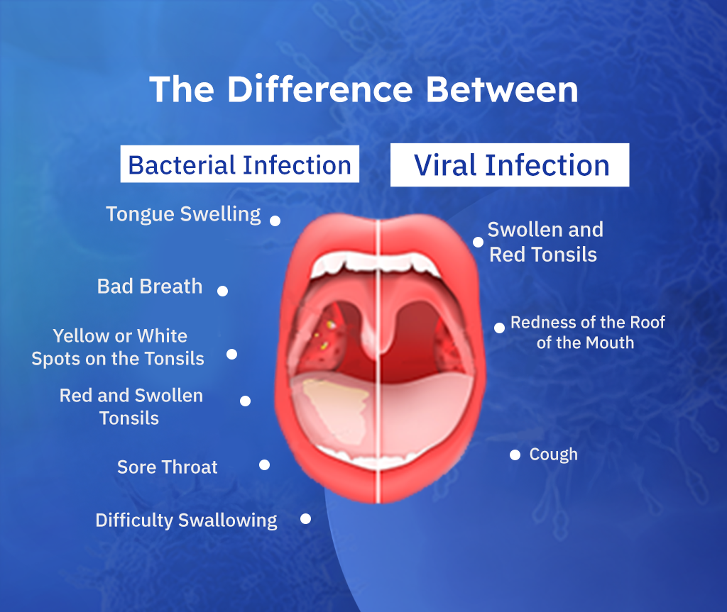 The Difference Between Viral and Bacterial Infections