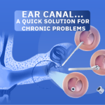 ear tubes