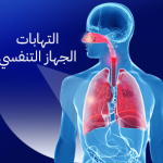 التهابات الجهاز التنفسي