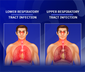 Respiratory infections
