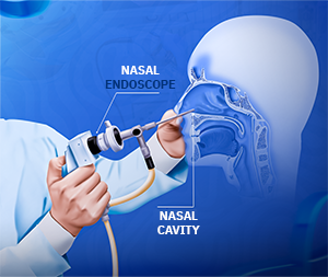 rhinoscope