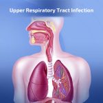 Upper Respiratory Tract Infection