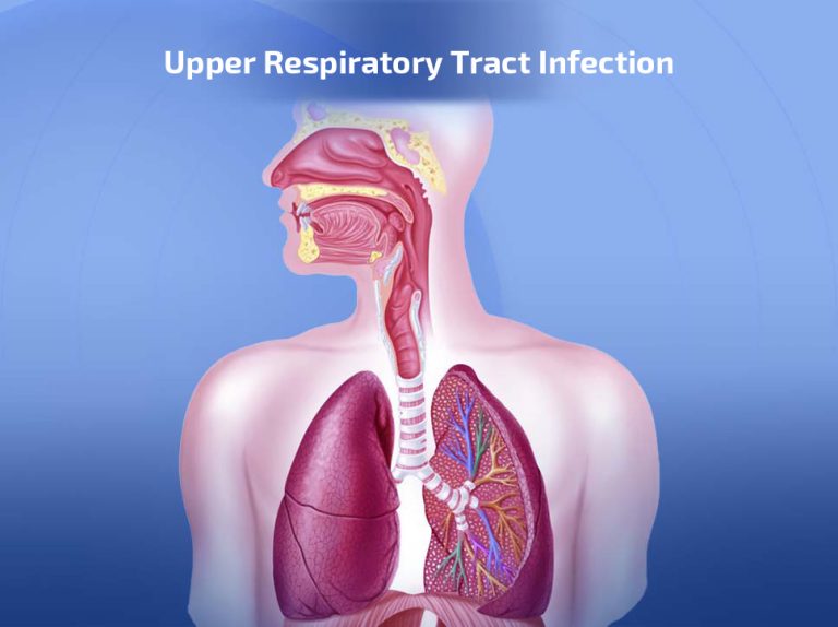 Upper Respiratory Tract Infection