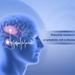Pulsatile Tinnitus