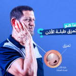 تمزق طبلة الأذن