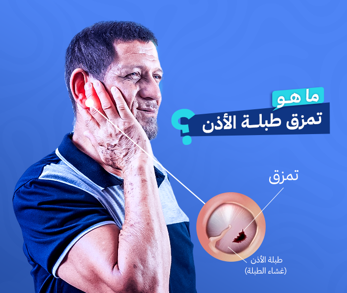تمزق طبلة الأذن