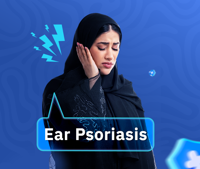 ear psoriasis