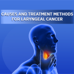 Laryngeal Cancer