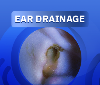Ear pus
