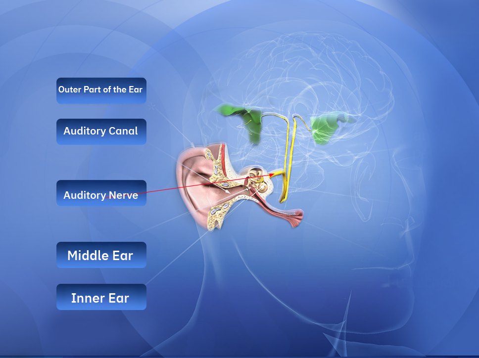 Auditory Nerve