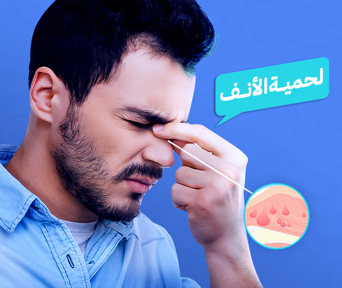 لحمية الأنف