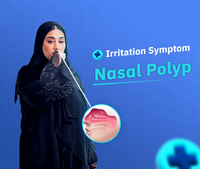 Nasal polyps
