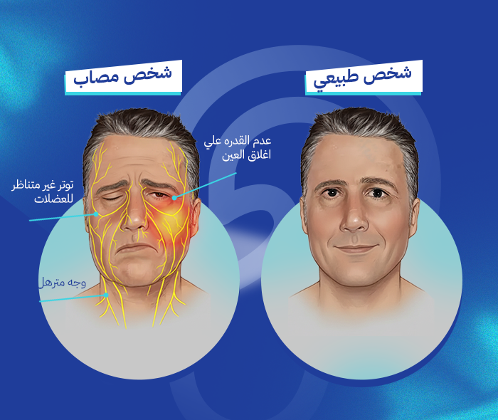 العصب السابع