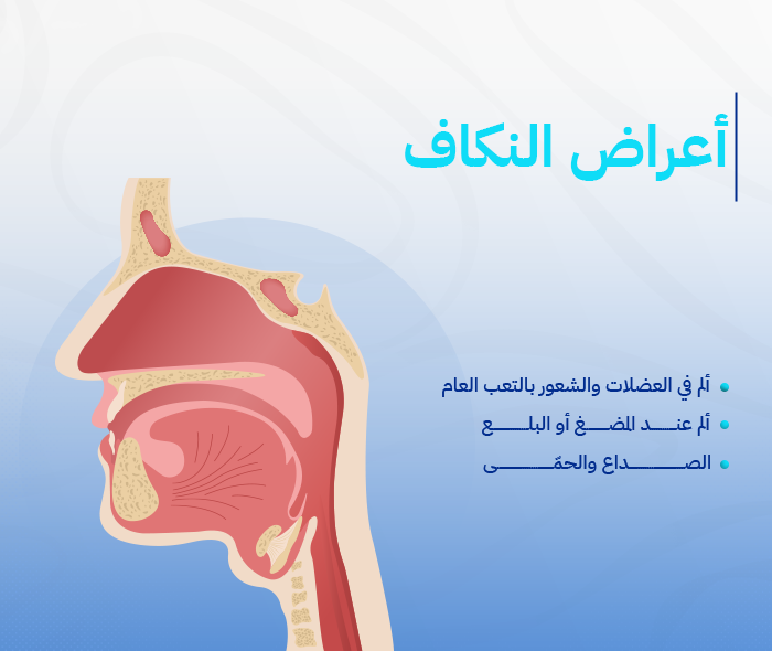 النكاف